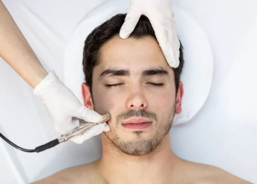 Exquisite Laser Clinic skin treatment Microdermabrasion Treatment