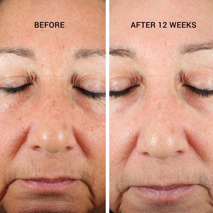 Retinoin PM Serum 5x